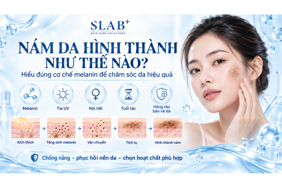 NÁM DA HÌNH THÀNH NHƯ THẾ NÀO? HIỂU ĐÚNG CƠ CHẾ ĐỂ CHĂM SÓC DA HIỆU QUẢ