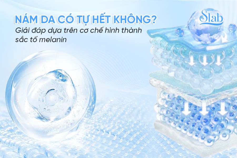 Nám da có tự hết không? Giải đáp dựa trên cơ chế hình thành sắc tố melanin