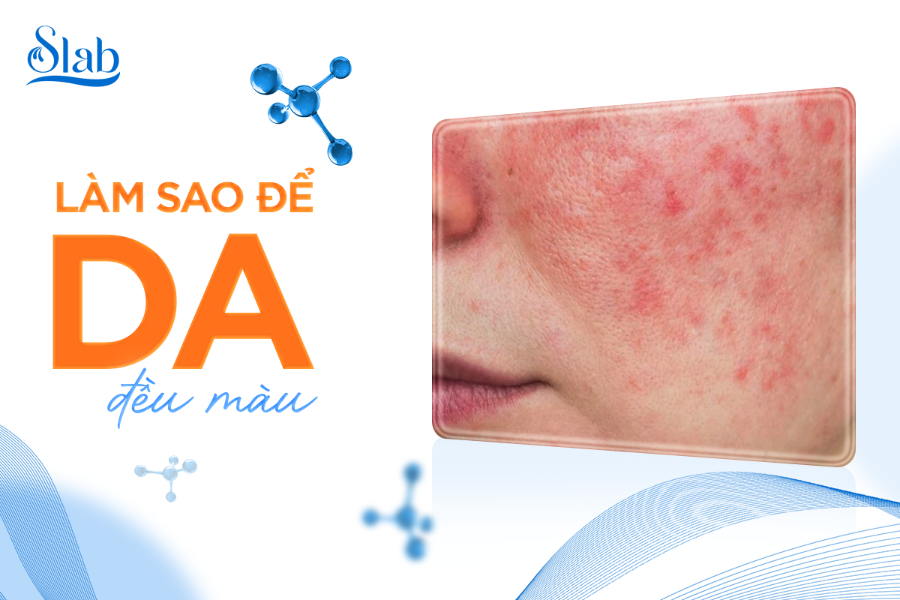 Làm sao để da đều màu? Bí quyết sáng da, mờ thâm không cần makeup