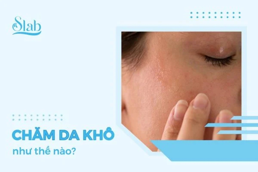 Chăm da khô như thế nào?