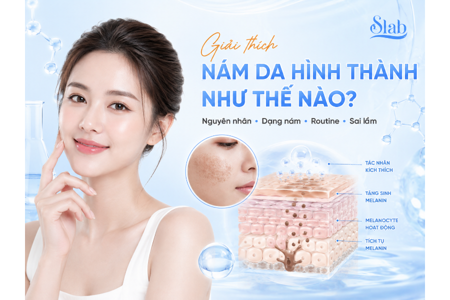 Nám da hình thành như thế nào? Nguyên nhân, các dạng nám và routine chăm sóc đúng cách