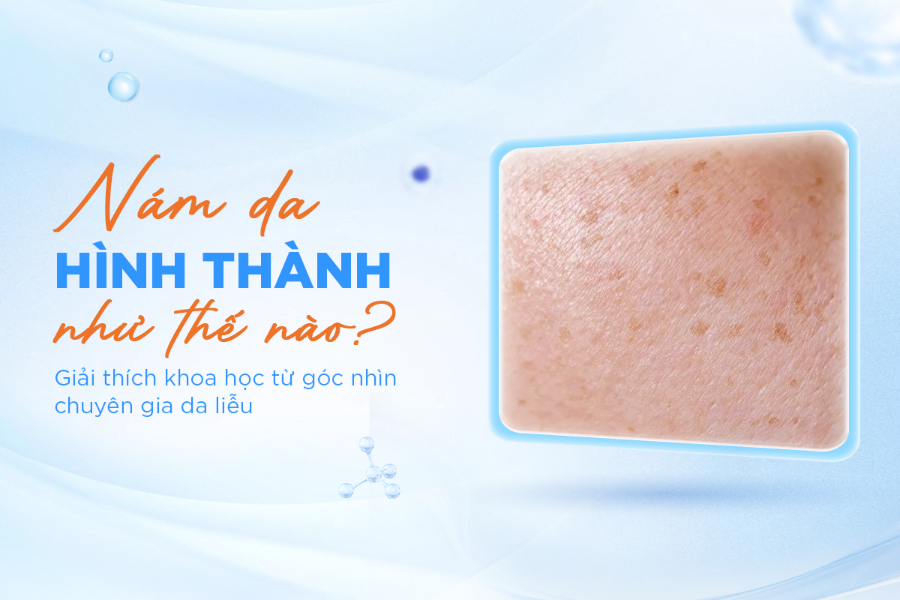 Nám da được hình thành như thế nào?