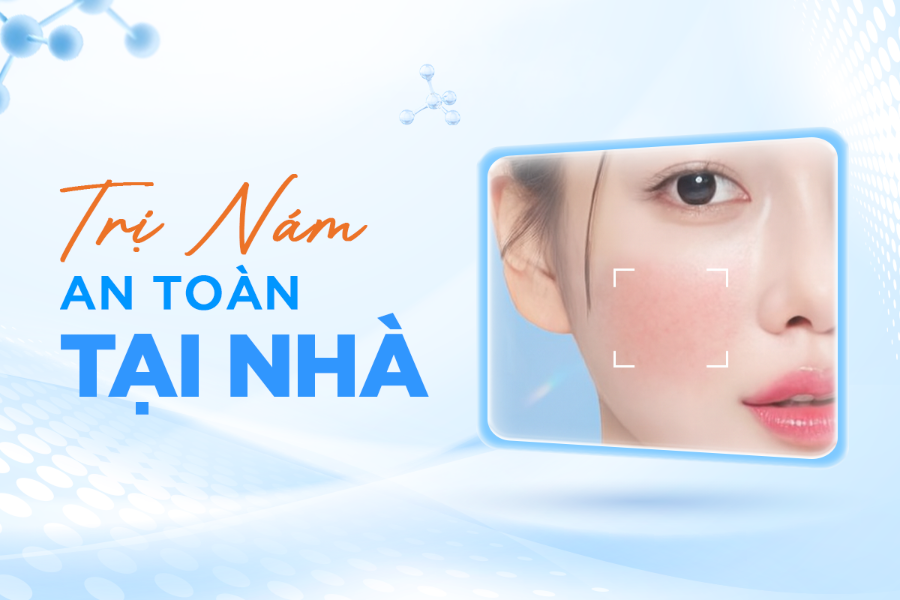 Trị Nám An Toàn Tại Nhà: Lộ Trình 3 Bước Chăm Sóc Da Nám Chuyên Sâu