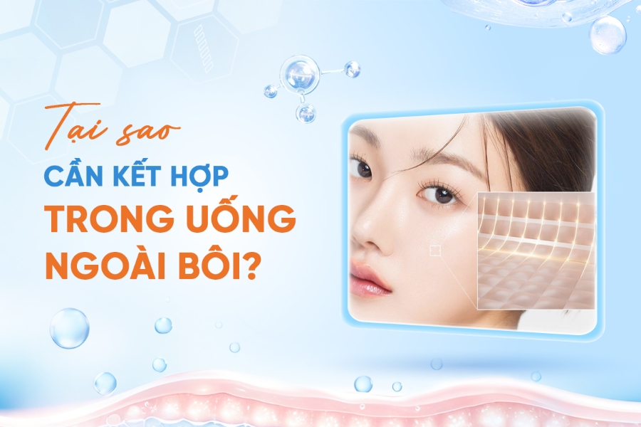 Trị Nám Tận Gốc: Tại Sao Cần Kết Hợp Bôi Thoa và Dưỡng Chất Từ Bên Trong?