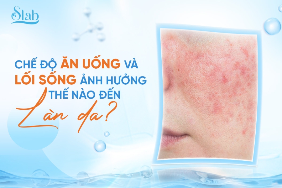 Chế độ ăn uống và lối sống ảnh hưởng thế nào đến làn da?